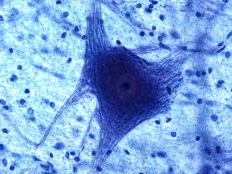 Integrative Dendritic Cell Immunotherapy Protocol in India