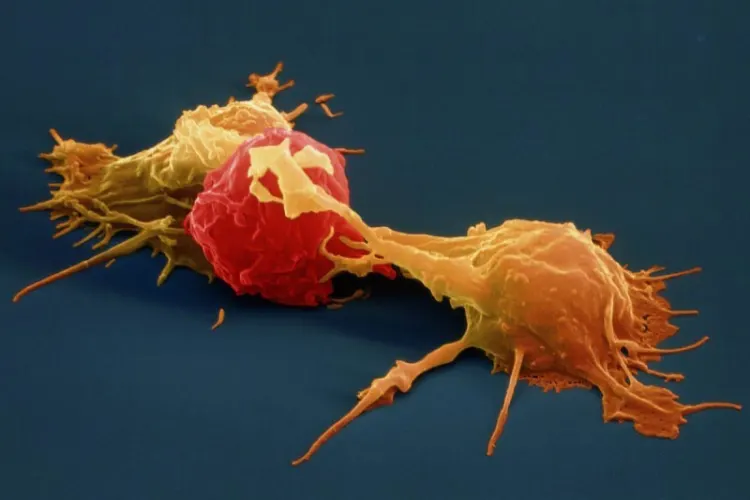 Natural Killer Cell Immunotherapy Protocol in India